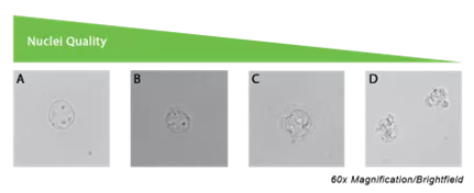 Nuclei quality